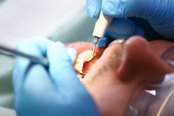 Best Knocked-Out Tooth Emergency  in Shattuck, OK