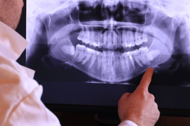 Best Dentist for Tooth Abscess  in Shattuck, OK