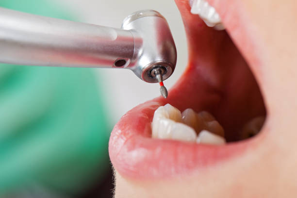 Best Urgent Tooth Repair  in Shattuck, OK